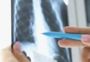 Fibrose Pulmonar: Entenda os Seus Sintomas
